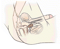 Male G-Spot